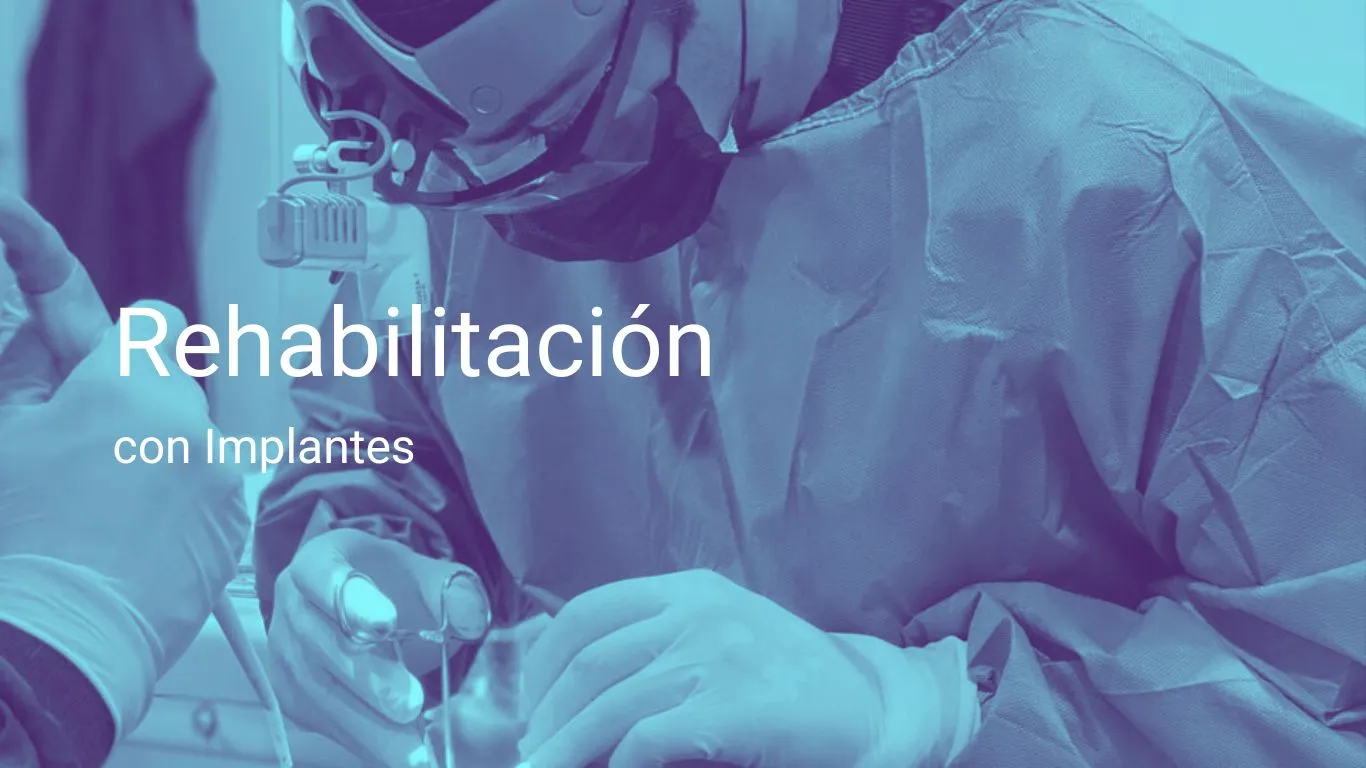 Rehabilitación con prótesis dental sobre implantes